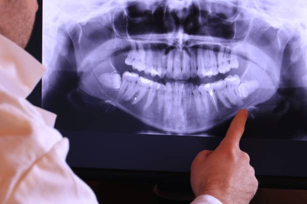 Best Cracked Tooth Emergency Dentist  in Auxvasse, MO
