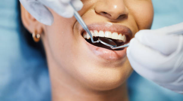 Best Tooth Infection Emergency Dentist  in Auxvasse, MO