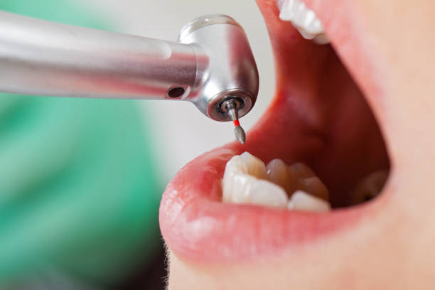 Urgent Tooth Repair in MO
